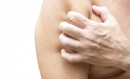 Kakvo Se Sluchva Pri Atopichna Kozha I Kak Mozhete Da Namalite Poyavata Na Ekzemi Bioderma