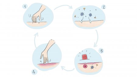 your-skin_SOS-spray_article1_vicious-itch-scratch-circle