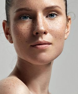 bioderma-your-skin_pigmentbio_c-concentrate_woman_stains_2