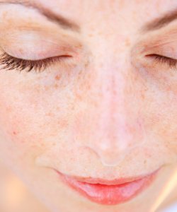 Sensitive skin role in lifestyle choices